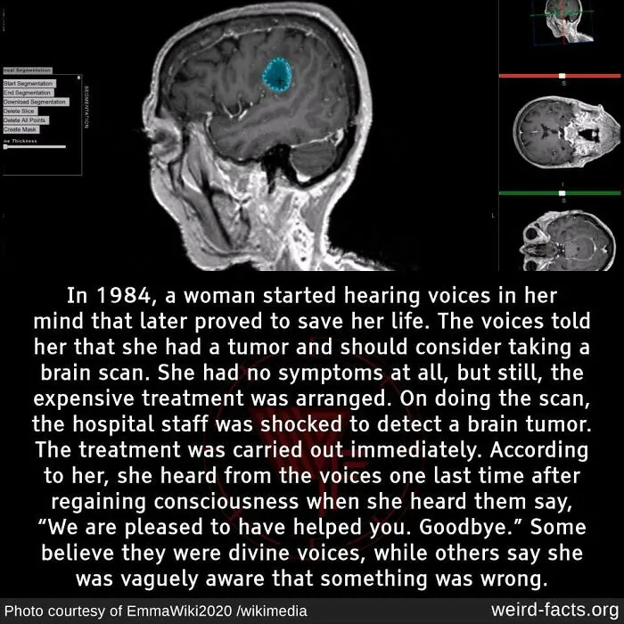 50 “Weird Facts” That You Might Not Have Known Before Today (New Pics)