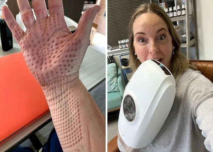 People With Trypophobia Might Not Agree With How Well This <span Style="Font:inherit;color:#d74b1f;"> Cordless Electric Hand Massager </Span> Works