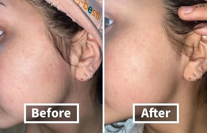 <span Style="Font: Inherit; Color: #d74b1f;"> Schick Dermaplaning Tool</Span>: The At-Home Dermaplaning Tool That's Taking Over Tiktok