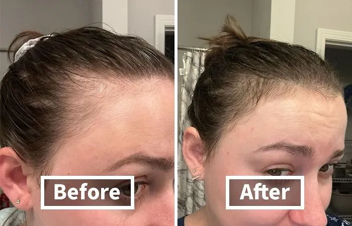 Ditch The Dry Scalp Drama And Get Your Hair Growing With <span Style="Font: Inherit; Color: #d74b1f;"> Mielle Organics Rosemary Mint Oil</Span>