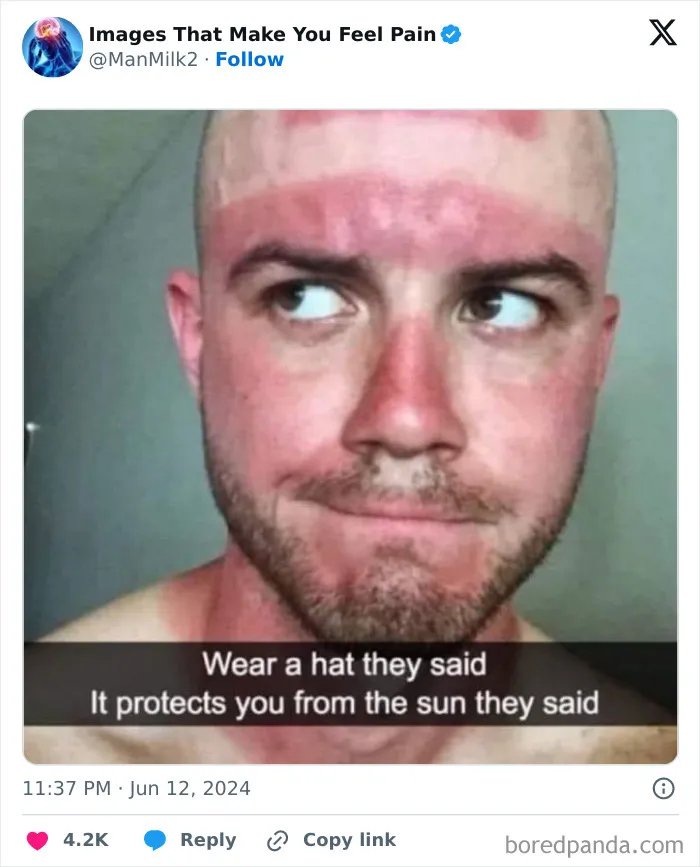 50 Painful Pics That Will Probably Make You Say “Okay, Enough Internet For Me For Today”
