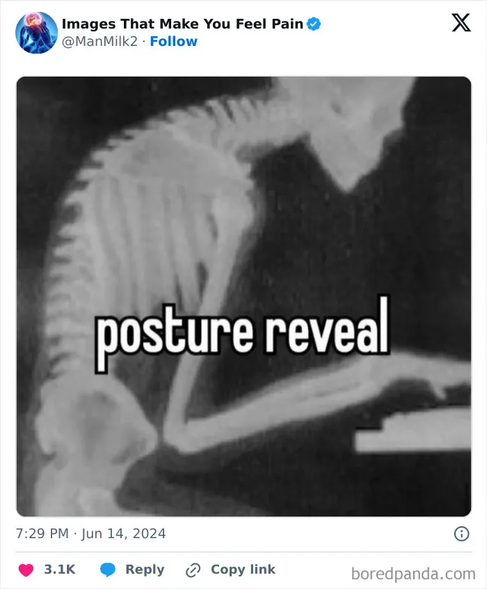 50 Painful Pics That Will Probably Make You Say “Okay, Enough Internet For Me For Today”