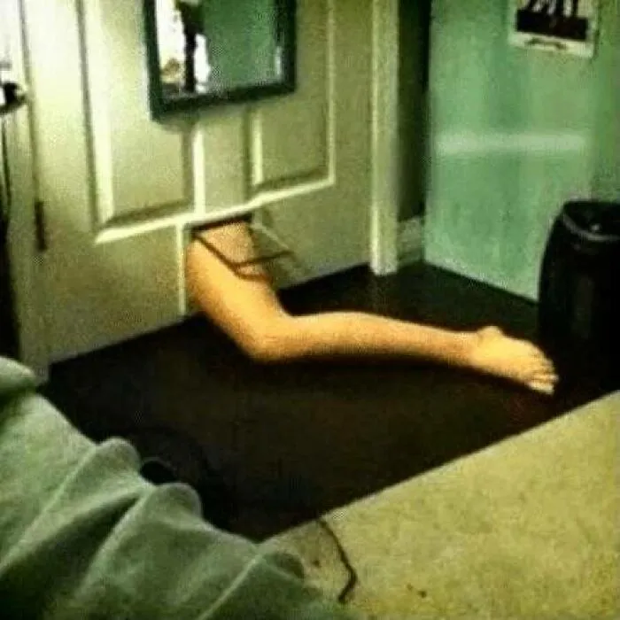 Leg