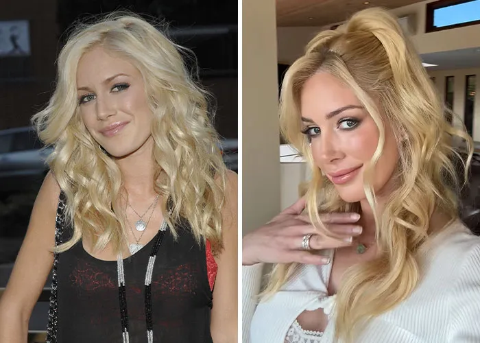 Heidi Montag before and after plastic surgery. Two images of a blonde celebrity woman, showcasing changes over time.