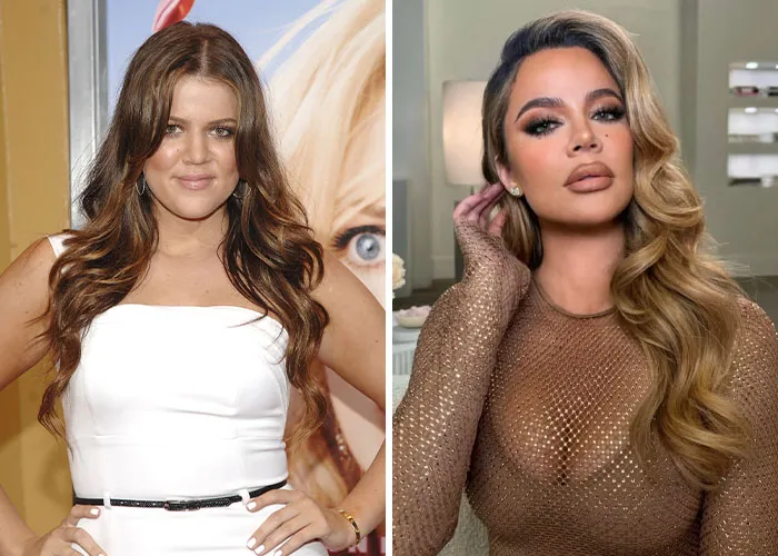 Khloé Kardashian