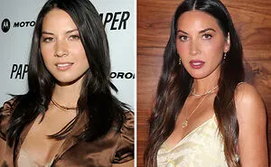 26 Celebrities Before And After Plastic Surgery, Kim Kardashian And Ariana Grande Included