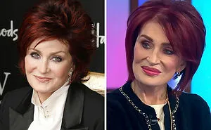 26 Celebrities Before And After Plastic Surgery, Kim Kardashian And Ariana Grande Included