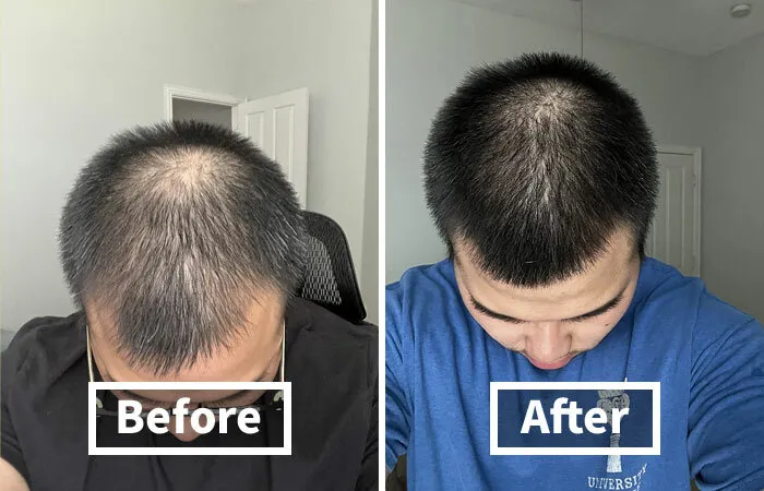 <span Style="Font: Inherit; Color: #d74b1f;"> Rosemary Biotin Shampoo</Span>: Hair So Healthy, It'll Practically Grow Overnight