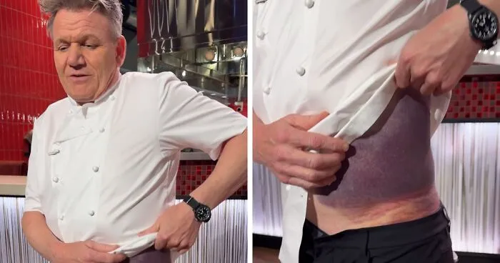 "I’m Lucky To Be Here": Gordon Ramsay Flooded With Recovery Wishes After Harrowing Accident