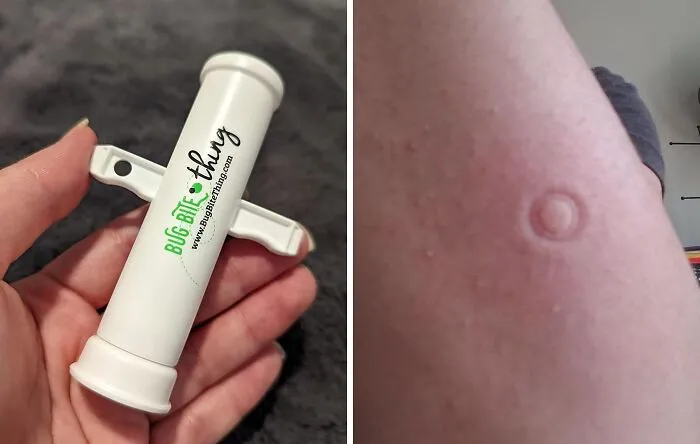Don't Scratch That Itch, Suck It Up With The <a Style="Display:inline;" Href="Https://Www.amazon.com/Bug-Bite-Thing-Suction-Remover/Dp/B01576dwqu?ie=utf8&linkcode=ll1&tag=bpcow-20&linkid=0afaa89f1b196bdca67ac92d85c1ab70&language=en_us&ref_=as_li_ss_tl" Target="_blank"><span Style="Font: Inherit; Color: #d74b1f;"> Bug Bite Thing Suction Tool</Span>