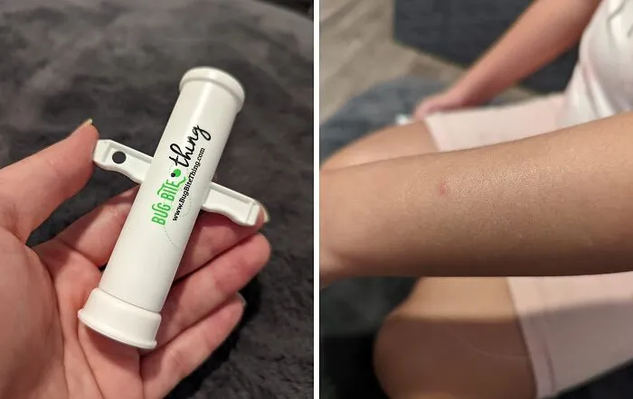 Find Relief From Itchy Bug Bites And Stings With The <a style="display:inline;" href="https://www.amazon.com/Bug-Bite-Thing-Suction-Remover/dp/B01576DWQU?ascsubtag=srctok-707e3b2553ff9c82&btn_ref=srctok-707e3b2553ff9c82&crid=31W9XITT90O3L&dib=eyJ2IjoiMSJ9.4KJIiVjRA3ElHBLv96KOhNlEQvLD5uAkNKO4-m3RRtiRmUbsG4qN2RFMyme0TwxxM7Lay0Wpx9fpbnTljDbIoLpkCRPChHbsBd_ngCeGt0KIl-tw9lbnVZmkCBzn86YLCrdRVqtLbm_oQaKuLivZXBm9vf6J094BNpzxLJ0tDhBSZwGKkvxZ0lplkoXpegO4ZpZmxnYhHe9SjRMtcHWivc7bCjBFscTHmBn7KhE_CALbgtCpCt1Im3ucZshpswxQrO1qncWpfM7pfR2DOV5CpU6BJTw9PKtIovuE9HITRxk.Xto6w4cVCYsOd8lNGepjubDCL1g9f0Rqnm2aqpUwtMw&dib_tag=se&keywords=mosquito%2Bbite%2Bsuction%2Btool&qid=1719804805&sprefix=mosquito%2Bbite%2Bsuction%2Btool%2Caps%2C88&sr=8-5&th=1&linkCode=ll1&tag=bplemur-20&linkId=c9f23aac7714dcafcb755fbc79fc4e4d&language=en_US&ref_=as_li_ss_tl"_blank"><span Style="Font: Inherit; Color: #d74b1f;"> Bug Bite Thing Suction Tool</Span>. This Innovative Device Uses Suction To Remove Insect Saliva/Venom From Under The Skin