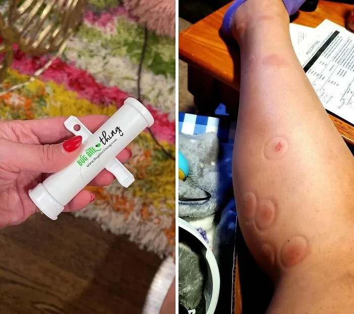 Finally, A Solution For Those Pesky Bites! The   <a Style="Display:inline;" Href="Https://Www.amazon.com/Bug-Bite-Thing-Suction-Remover/Dp/B01576dwqu?crid=2m876bxuf4a3&dib=eyj2ijoimsj9.pzstsywgs0ffmftxejfh9hzakuajsbuppfcdenynbfbgdg24cmmgyu4tvowpuub6anye-Nvmhazjg-Joutmxguvixkbwwnyxgqrcpinwzj_jlglukmrbpuezh7imrwmpcm4hvsthns2f0yldamr_nh-Wmhoploncsw9an_3fxrs4wgfdjkyfqyij5pmsqf4h_ihzmggk4x6heu52fjdnzfajo4yjaei7l2-Tsgxea_y00o-Dr9qm4n1tvwdyphqoze-_xh9fr7se8gpct1wzwg7ysjo77naj-6vsckpej44.qsvdm2vils3lmlsq8wvzk3o_pofubucg-Tnkoeqey58&dib_tag=se&keywords=unique+things&qid=1719581676&sprefix=unique+things%2caps%2c206&sr=8-2&linkcode=ll1&tag=bpcrocodile-20&linkid=a27d29ef78805447ddc59a7d4270bec3&language=en_us&ref_=as_li_ss_tl"_blank"><span Style="Font: Inherit; Color: #d74b1f;"> Bug Bite Thing Suction Tool</Span> Will Quickly Become Your Go-To Remedy For Summer Itching