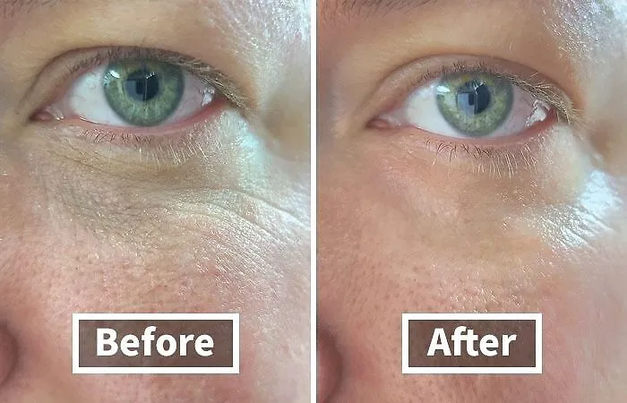 Even Pandas Need A Little Help With Dark Circles. <a Style="Display:inline;" Href="Https://Www.amazon.com/Gp/Product/B00jjpmxdo?&linkcode=ll1&tag=bpdolphin-20&linkid=88ceb79e55c5897dade4663111817c42&language=en_us&ref_=as_li_ss_tl" Target="_blank"><span Style="Font: Inherit; Color: #d74b1f;"> Cerave Eye Repair Cream</Span> Is The Go-To For Reducing Puffiness And Brightening The Eye Area