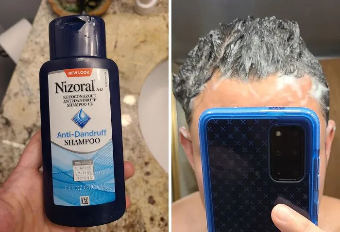 Experience The Difference Of A Dandruff Shampoo That Actually Works With <a Style="Display:inline;" Href="Https://Www.amazon.com/Dp/B00ainmfac?ascsubtag=7692517%2c10%2c25%2cd%2c0%2c0%2cbf-Web-Hf%2c900%3a2%3b974%3a3%3b1125%3a1%3b1242%3a1%2c47489236%2c0%2c0%2c0&btn_ref=srctok-E06bd9e57f3fc8e2&linkcode=ll1&tag=bpfish-20&linkid=7bc2404c4ab9db64e5c0c61d7e2fbb45&language=en_us&ref_=as_li_ss_tl" Target="_blank"><span Style="Font: Inherit; Color: #d74b1f;"> Nizoral Anti-Dandruff Shampoo</Span>, The Dermatologist-Recommended Solution For Dandruff Control