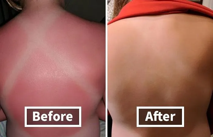 Soothe Your Sun-Kissed Skin With The Natural Goodness Of <a Style="Display:inline;" Href="Https://Www.amazon.com/Burts-Bees-Coconut-Soother-Sunburn/Dp/B0013l55u0?ie=utf8&linkcode=ll1&tag=bpdodo-20&linkid=54baa55a66580dc891a116899c3d404b&language=en_us&ref_=as_li_ss_tl" Target="_blank"><span Style="Font: Inherit; Color: #d74b1f;"> Burt's Bees After Sun Lotion</Span>, Enriched With Hydrating Aloe Vera And Coconut Oil