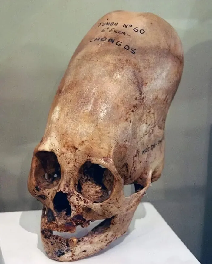 Elongated skull displayed in a museum, showcasing oddly terrifying features.