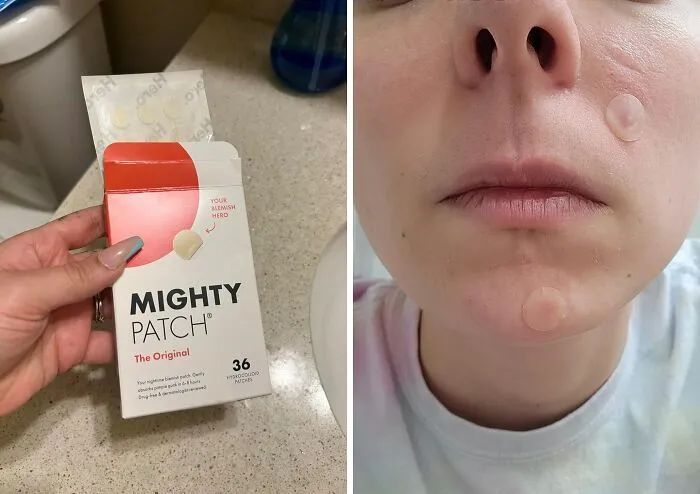 This <a Style="Display:inline;" Href=" Https://Www.amazon.com/Mighty-Patch-Hydrocolloid-Absorbing-Count/Dp/B074pvtpbw?pd_rd_w=tosyq&content-ID=amzn1.sym.7379aab7-0dd8-4729-B0b5-2074f1cb413d&pf_rd_p=7379aab7-0dd8-4729-B0b5-2074f1cb413d&pf_rd_r=937fejn50190t91ex89x&pd_rd_wg=qzabc&pd_rd_r=05c09c1b-2679-40e4-B992-17cd733d51f9&pd_rd_i=b074pvtpbw&psc=1&linkcode=ll1&tag=bpzebra-20&linkid=56963bb068759aa768455e4b8f1432fc&language=en_us&ref_=as_li_ss_tl " Target="_blank"><span Style="Font: Inherit; Color: #d74b1f;"> Pimple Patch</Span> Is The Invisibility Cloak Your Zit Wishes It Had.