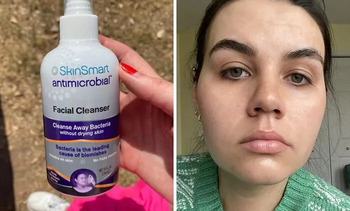 This <a Style="Display:inline;" Href="Https://Www.amazon.com/Skinsmart-Cleanser-Bacteria-Athletes-Multiple/Dp/B07vrfc3y7?ie=utf8&linkcode=ll1&tag=bpbat-20&linkid=85aab0e53db69fd863cd4073eee8fb1b&language=en_us&ref_=as_li_ss_tl" Target="_blank"><span Style="Font: Inherit; Color: #d74b1f;"> Skinsmart Facial Cleanser</Span> Is The Bacteria-Blasting Bodyguard Your Thirty-Something Skin Has Been Begging For