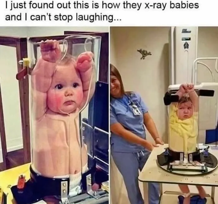 A baby in a tube during an X-ray, resembling a funny meme moment.