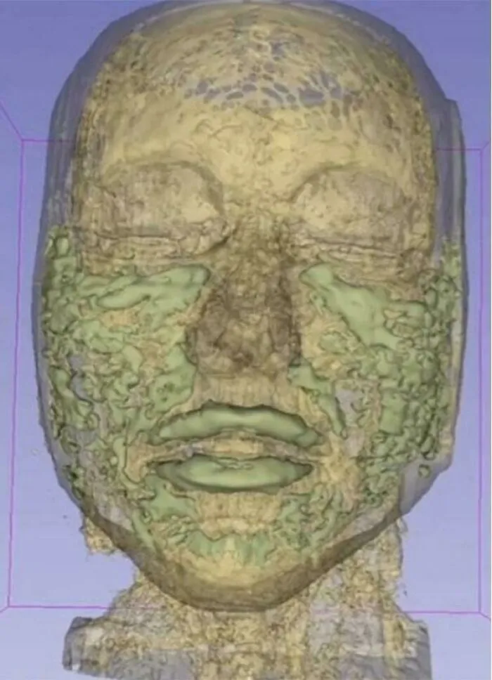 3D scan of a human face with eerie textures, creating an oddly terrifying effect.
