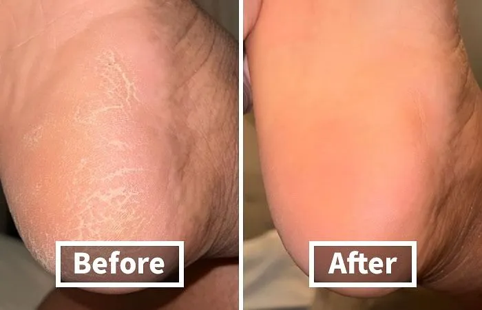 It Seems Like Prime Day Was The Perfect Excuse For Pandas To Pamper Their Paws Thanks To <a Style="Display:inline;" Href="Https://Www.amazon.com/Lee-Beauty-Professional-Strength-Pedicure/Dp/B01ncmjpoq?ie=utf8&linkcode=ll1&tag=bppeacock-20&linkid=fc8a93688ea3d3e71500b272c9df55fd&language=en_us&ref_=as_li_ss_tl" Target="_blank"><span Style="Font: Inherit; Color: #d74b1f;"> Callus Remover Gel</Span>