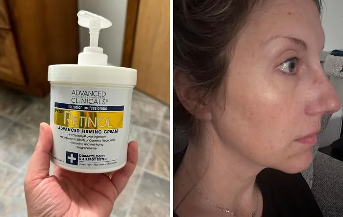 Users Are Turning Back The Clock With This Prime Day Steal: The <a Style="Display:inline;" Href="Https://Www.amazon.com/Advanced-Clinicals-Professionals-Moisturizing-Penetrates/Dp/B00di9iiek?ie=utf8&linkcode=ll1&tag=bppeacock-20&linkid=47ca49bfadda83bce2a7e0c567fae4b9&language=en_us&ref_=as_li_ss_tl" Target="_blank"><span Style="Font: Inherit; Color: #d74b1f;"> Advanced Clinicals Retinol Body Lotion</Span> That's Making Wrinkles A Distant Memory