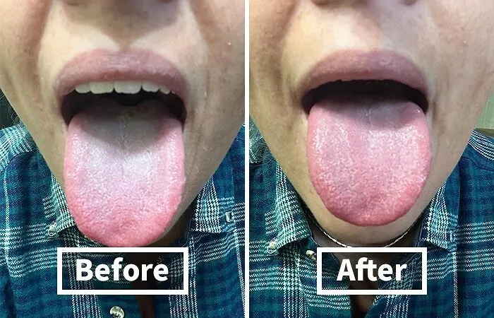 No Matter How You Try To Spin It, Our Mouthes Are Pretty Gross. So Replace Your <span Style="Font:inherit;color:#d74b1f;"> Tongue Scraper </Span> One In A While To Keep Things Hygienic