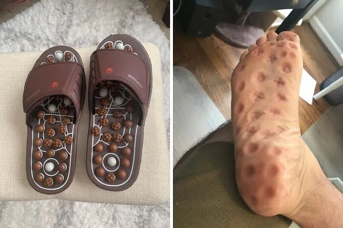 Your Feet Will Be Singing Your Praises After Experiencing The Rejuvenating Magic Of These <a Style="Display:inline;" Href="Https://Www.amazon.com/Byriver-Acupressure-Massager-Acupoint-Reflexology/Dp/B0795nd4v3?dib=eyj2ijoimsj9.6q41iwcyfgwzu4u-Bckypwki1lzjfkjw-Masw_fzw4l_mb2ousqhabdvkpnmzybrqxy-Sutoewuwmfde2uysri1bp0rlfkwhb-5lv_r580w3fc9lqwyfne44jfhhpxkwagskckbudjow3ebjybezs_bggoyszytcbhmw3t2ltoa-Qs2ar9ljgkydqhqz1vujpthemqbsccj8g7cpcubimffze9wktyhctbjethnjymrvr8q_eka2nifnnax28luux3umiembjwg-Aqx_prxjscsbsa556t3i2z6ujzjyobc.-Acd44yt4vmwaieexch0g-Ov-Pjikjbxvgm5h1ucu6q&dib_tag=se&keywords=unique%2bproducts&qid=1721397271&sr=8-22-Spons&sp_csd=d2lkz2v0tmftzt1zcf9tdgy&th=1&linkcode=ll1&tag=bpcrab-20&linkid=9efd7b3c9a91815e88da77f609dd77c0&language=en_us&ref_=as_li_ss_tl" Target="_blank"><span Style="Font: Inherit; Color: #d74b1f;"> Acupoint Stimulation Massage Slippers</Span>