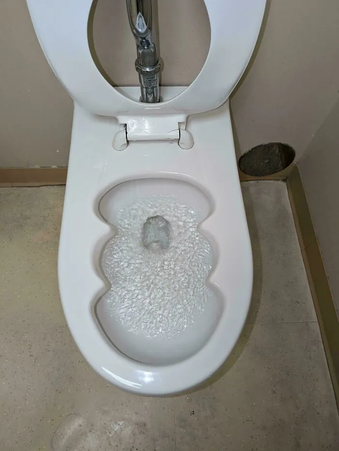 Esta extraña forma de taza de váter en la consulta de un médico