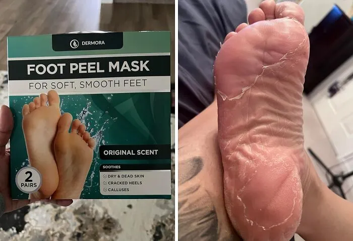 This <a Style="Display:inline;" Href="Https://Www.amazon.com/Foot-Peel-Callus-Mask-Dry/Dp/B078wctvv9?ie=utf8&linkcode=ll1&tag=bparmadillo-20&linkid=f2f61f5405bc4e21d4d03c392d40efb6&language=en_us&ref_=as_li_ss_tl"_blank"><span Style="Font: Inherit; Color: #d74b1f;"> Foot Peel Mask</Span> Is The Secret Weapon For Baby-Soft Feet, Even If You've Been Neglecting Your Pedicure Routine For Months