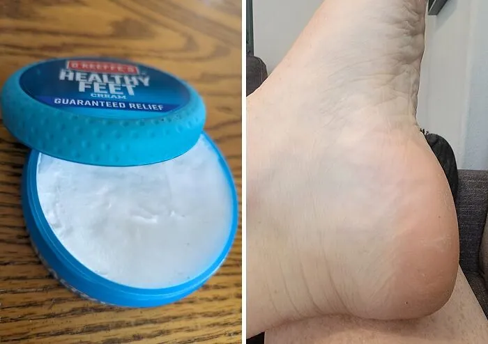 This <a Style="Display:inline;" Href="Https://Www.amazon.com/Okeeffes-Healthy-Feet-Cream-Ounce/Dp/B0002qb9ne?ie=utf8&linkcode=ll1&tag=bparmadillo-20&linkid=cecbb55530b958de74fe3c23f6f0b9f2&language=en_us&ref_=as_li_ss_tl"_blank"><span Style="Font: Inherit; Color: #d74b1f;"> O'keeffe's For Healthy Feet Foot Cream</Span> Is The Hardworking Hero Your Tired, Cracked Heels Have Been Begging For