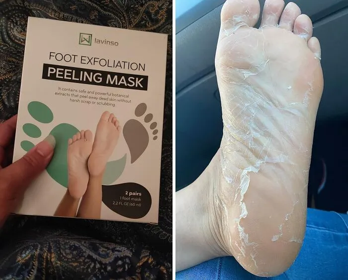 Your Feet Deserve A Spa Day, And This <a Style="Display:inline;" Href=" Https://Www.amazon.com/Foot-Peel-Mask-Cracked-Feet/Dp/B074mnf659?ie=utf8&linkcode=ll1&tag=bpcobra-20&linkid=b7ea7b0dc7f266e6cab39b7654fe845b&language=en_us&ref_=as_li_ss_tl" Target="_blank"><span Style="Font: Inherit; Color: #d74b1f;"> Foot Peel Mask</Span> Is Your Ticket To Baby-Soft Skin! 