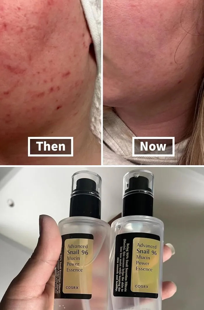 This <a Style="Display:inline;" Href=" Https://Www.amazon.com/COSRX-Repairing-Hydrating-Secretion-Phthalates/Dp/B00pbx3l7k?th=1&psc=1&linkcode=ll1&tag=bpturtle-20&linkid=6573480d6ef198631764cf2e35ec8466&language=en_us&ref_=as_li_ss_tl" Target="_blank"><span Style="Font: Inherit; Color: #d74b1f;"> COSRX Snail Mucin 96% Power Repairing Essence</Span> Is The Cult-Favorite Product That's Been Transforming Complexions Worldwide – It's Time To See What The Hype Is All About!