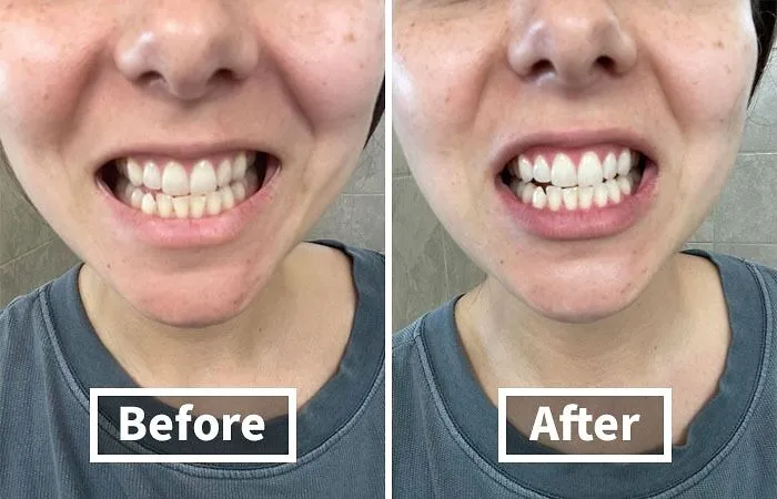 Honourable Mention: <a Style="Display:inline;" Href="Https://Www.amazon.com/Venus-Visage-Corrector-Purple-Toothpaste/Dp/B0c745g1p4?&linkcode=ll1&tag=bpcorgi-20&linkid=828191f253fb5f9874cfba2e8036d223&language=en_us&ref_=as_li_ss_tl" Target="_blank"><span Style="Font: Inherit; Color: #d74b1f;"> Venus Visage V34 Colour Corrector Toothpaste</Span> Might Look Weird, But It's Like Photoshop For Your Smile