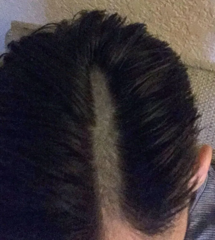 Se ha pasado con la maquinilla