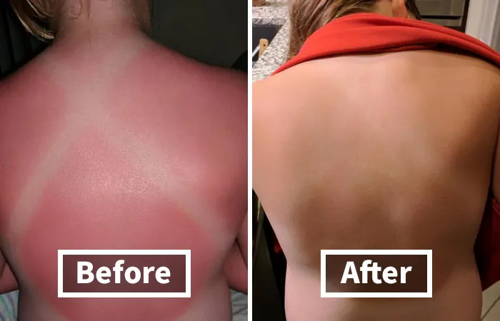 <a Style="Display:inline;" Href="Https://Www.amazon.com/Burts-Bees-Coconut-Soother-Sunburn/Dp/B0013l55u0?ie=utf8&linkcode=ll1&tag=bpstingray-20&linkid=295fa466641f0453de1befe4eb49a1a1&language=en_us&ref_=as_li_ss_tl" Target="_blank"><span Style="Font: Inherit; Color: #d74b1f;"> Burt's Bees After Sun Lotion</Span> Enlists The Help Of Aloe Vera And Coconut Oil For Cooling And Hydrating Relief