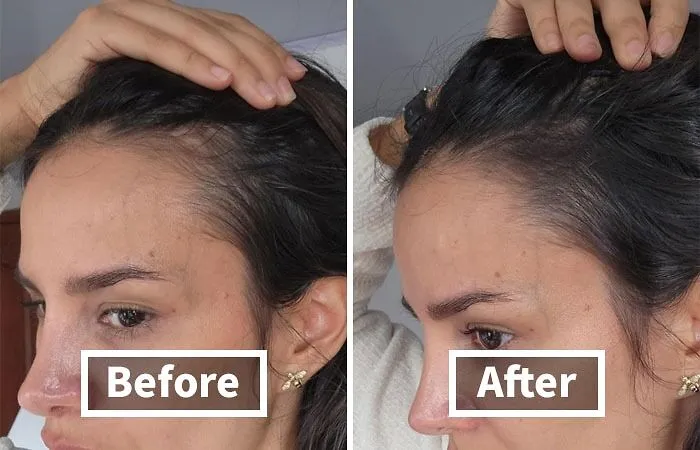 Thinning Hair? No Problem!  <a Style="Display:inline;" Href="Https://Www.amazon.com/Hairline-Instantly-Conceals-Thinning-Stain-Proof/Dp/B08n1cwl7s?psc=1&linkcode=ll1&tag=bpwombat-20&linkid=7da4392cb0cffea5b6604d7561c9afca&language=en_us&ref_=as_li_ss_tl" Target="_blank"><span Style="Font: Inherit; Color: #d74b1f;"> Boldify Hairline Powder</Span> Gives You A Fuller, Thicker Look In Seconds