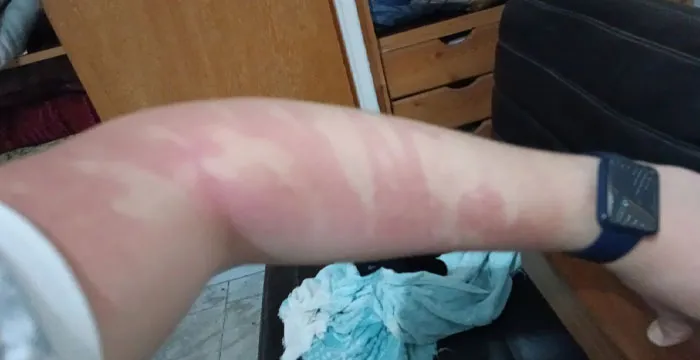 I've Put Sunscreen On My Face And Wiped My Fingers On My Arm
