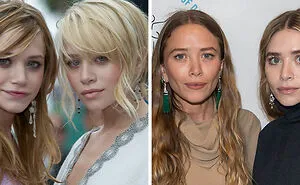 What 14 Famous Stars Looked Like Before Their Stunning Cheekbone Transformations
