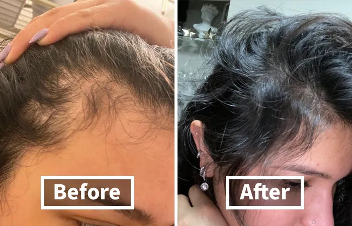 Say Goodbye To Hair Loss And Hello To Luscious Locks With <a Style="Display:inline;" Href="Https://Www.amazon.com/Gp/Product/B01encboa0?&linkcode=ll1&tag=bpdolphin-20&linkid=8521e2ff9cbe88b74b99fca1687eef6e&language=en_us&ref_=as_li_ss_tl" Target="_blank"><span Style="Font: Inherit; Color: #d74b1f;"> Rosemary Biotin Shampoo For Hair Growth</Span>