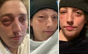 Bad Day, Huh: 50 People Having A Really Unfortunate Day (New Pics)