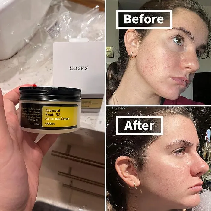 This <a Style="Display:inline;" Href=" Https://Www.amazon.com/COSRX-Moisturizer-Acne-Prone-Sensitive-Parabens/Dp/B01lej5msk?th=1&psc=1&linkcode=ll1&tag=bpturtle-20&linkid=ab9a0cc48d7f9a71e0775650fb4d8489&language=en_us&ref_=as_li_ss_tl" Target="_blank"><span Style="Font: Inherit; Color: #d74b1f;"> COSRX Snail Mucin Cream</Span> Is The All-In-One Solution For Dry, Acne-Prone, And Sensitive Skin, Delivering Deep Hydration And Gentle Repair
