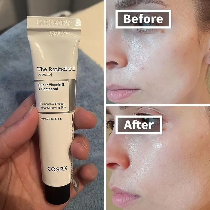 <a Style="Display:inline;" Href=" Https://Www.amazon.com/COSRX-Anti-Aging-Retinoid-Treatment-Wrinkles/Dp/B0cm8m8hp8?th=1&psc=1&linkcode=ll1&tag=bpturtle-20&linkid=7010734c6940fc678fdcd88f2ebd381f&language=en_us&ref_=as_li_ss_tl" Target="_blank"><span Style="Font: Inherit; Color: #d74b1f;"> COSRX Retinol Cream</Span> Is Your Skin's Time Machine, Turning Back The Clock On Wrinkles And Fine Lines