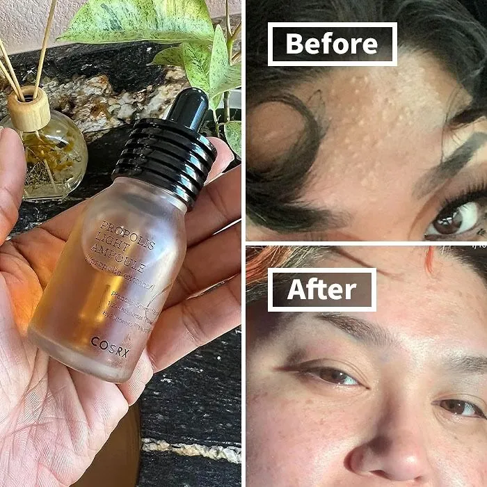Your Skin Will Be Humming With Happiness After Experiencing The Nourishing And Brightening Benefits Of <a Style="Display:inline;" Href=" Https://Www.amazon.com/COSRX-Propolis-Light-Ampule-Fl-Oz/Dp/B07zgjqz8g?th=1&psc=1&linkcode=ll1&tag=bpturtle-20&linkid=9a960463a5c38f6d3fdf489ac93012a7&language=en_us&ref_=as_li_ss_tl" Target="_blank"> <span Style="Font: Inherit; Color: #d74b1f;"> COSRX Propolis Ampoule</Span>