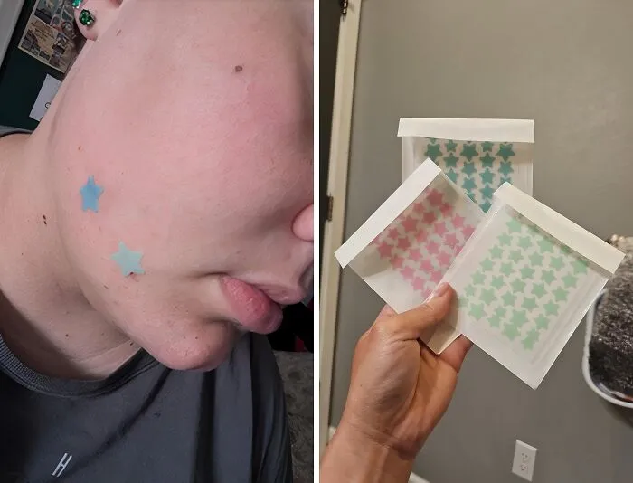 These <a Style="Display:inline;" Href=" Https://Www.amazon.com/Pimple-Patches-Face-Hydrocolloid-Containing/Dp/B0cyz3m87k?crid=169mrvo9gopv1&dib=eyj2ijoimsj9.05xeonmyfxcxeheyttyjzra7kf2i1dy8i655o-Erbu0hyqbd-1u8hv0rxpkgb5btrtcfueaofdj4enag8fe_lotivt1p59ohkmlund_ilha8fvlcumq-Q9ew_eqnnmylz6_tq577uwqxd-Y_phr8pko7xw0_fr8gtcyyflkfprqyesttjeak28ntp60542wgdasatmdzeoypfakjwr4ftlhmrd-Ntmfijpbtv28fawdiyo8ephjqy0u4s9ws-9n0zgoedvqayj0oyniaob-C1tg2bs78_xhele4ifslgh08.xzb7agpqaakv0vd-Npq6ygz4denz599wk4cmxt2cgpq&dib_tag=se&keywords=unique+products&qid=1722579946&sprefix=unique+pro%2caps%2c199&sr=8-78&linkcode=ll1&tag=bpdonkey-20&linkid=71b8e144a7edfbec1913e6fb46f1ae05&language=en_us&ref_=as_li_ss_tl" Target="_blank"><span Style="Font: Inherit; Color: #d74b1f;"> Star Pimple Patches</Span> Are The Celestial Solution To Your Breakout Blues, Turning Those Pesky Pimples Into A Constellation Of Cuteness