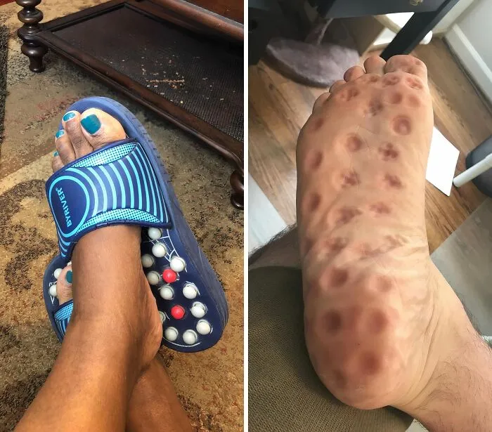 Step Into A World Of Comfort And Relaxation With These <a Style="Display:inline;" Href=" Https://Www.amazon.com/Byriver-Acupressure-Massager-Acupoint-Reflexology/Dp/B0795nd4v3?dib=eyj2ijoimsj9.6q41iwcyfgwzu4u-Bckypwki1lzjfkjw-Masw_fzw4l_mb2ousqhabdvkpnmzybrqxy-Sutoewuwmfde2uysri1bp0rlfkwhb-5lv_r580w3fc9lqwyfne44jfhhpxkwagskckbudjow3ebjybezs_bggoyszytcbhmw3t2ltoa-Qs2ar9ljgkydqhqz1vujpthemqbsccj8g7cpcubimffze9wktyhctbjethnjymrvr8q_eka2nifnnax28luux3umiembjwg-Aqx_prxjscsbsa556t3i2z6ujzjyobc.-Acd44yt4vmwaieexch0g-Ov-Pjikjbxvgm5h1ucu6q&dib_tag=se&keywords=unique%2bproducts&qid=1721397271&sr=8-22-Spons&sp_csd=d2lkz2v0tmftzt1zcf9tdgy&th=1&linkcode=ll1&tag=bpdonkey-20&linkid=328c9cf6bff73743b14e62b0ed9a9e3e&language=en_us&ref_=as_li_ss_tl" Target="_blank"><span Style="Font: Inherit; Color: #d74b1f;"> Acupoint Stimulation Massage Sandals</Span> - The Perfect Way To Pamper Your Feet And Improve Your Overall Well-Being