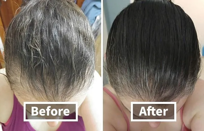 Thinning Hair Got You Down? Don't Surrender To The Struggle! <a Style="Display:inline;" Href="Https://Www.amazon.com/Biotin-Hair-Shampoo-Thinning-Moisturizing/Dp/B01encboa0?ie=utf8&linkcode=ll1&tag=bpdolphin-20&linkid=3f7caa8d2a29111b13395e779264d04d&language=en_us&ref_=as_li_ss_tl"_blank"><span Style="Font: Inherit; Color: #d74b1f;"> Rosemary And Biotin Shampoo</Span> Is Here To Fight Back, Promoting Thicker, Fuller Hair And A Revitalized Scalp