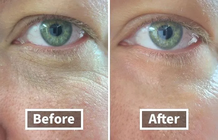 Late Nights And Early Mornings Got Your Eyes Looking Like They've Seen Better Days? <a Style="Display:inline;" Href="Https://Www.amazon.com/CeraVe-Repair-Cream-Circles-Puffiness/Dp/B00jjpmxdo?ie=utf8&linkcode=ll1&tag=bpdolphin-20&linkid=d0e5d311cedecbdc54cc034b374a4303&language=en_us&ref_=as_li_ss_tl"_blank"><span Style="Font: Inherit; Color: #d74b1f;"> CeraVe Eye Repair Cream</Span> Is The Pick-Me-Up Your Peepers Need!