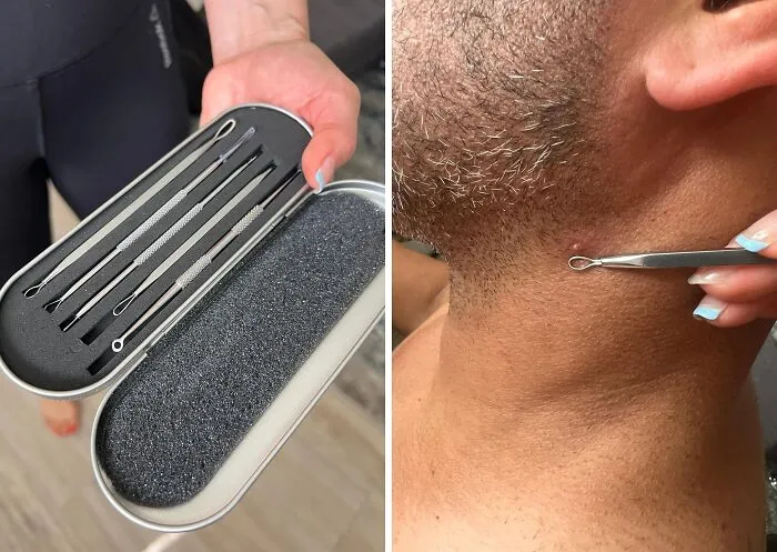 Pore Patrol: This <a Style="Display:inline;" Href="Https://Www.amazon.com/Bestope-Blackhead-Remover-Comedone-Extractor/Dp/B019svhley?ie=utf8&linkcode=ll1&tag=bpdolphin-20&linkid=436795a20b878194ca14d80ab6ae39ff&language=en_us&ref_=as_li_ss_tl"_blank"><span Style="Font: Inherit; Color: #d74b1f;"> Blackhead Remover Tool Kit</Span> Is On The Case!