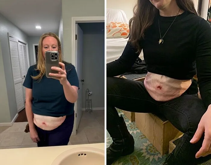 This <a Style="Display:inline;" Href=" Https://Www.amazon.com/Elephant-Exchange-Christmas-Beerbelly-Boyfriend/Dp/B07tbdn1jb?ie=utf8&linkcode=ll1&tag=bpraccoon-20&linkid=45ee0641e3c793aedfc99176a4aca314&language=en_us&ref_=as_li_ss_tl" Target="_blank"><span Style="Font: Inherit; Color: #d74b1f;"> Belly Waist Bag</Span> Is The Hands-Free Fashion Statement That Says "I'm Ready For Adventure, And I've Got Snacks!"